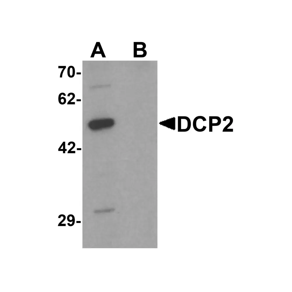 ProSci 7049 DCP2 Antibody, ProSci, 0.1 mg/Unit Primary Image