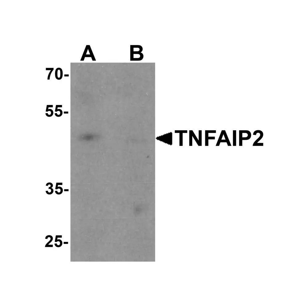 ProSci 7051 TNFAIP2 Antibody, ProSci, 0.1 mg/Unit Primary Image