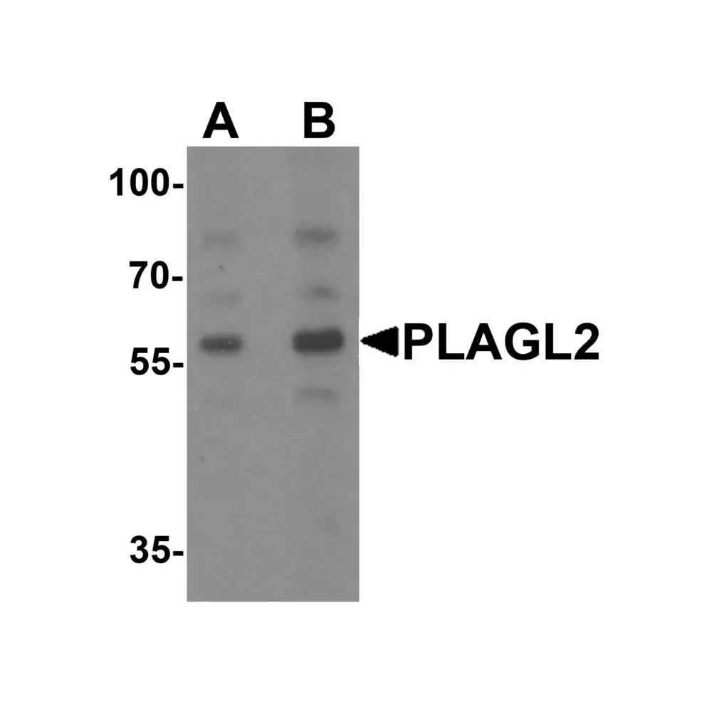 ProSci 7053_S PLAGL2 Antibody, ProSci, 0.02 mg/Unit Primary Image