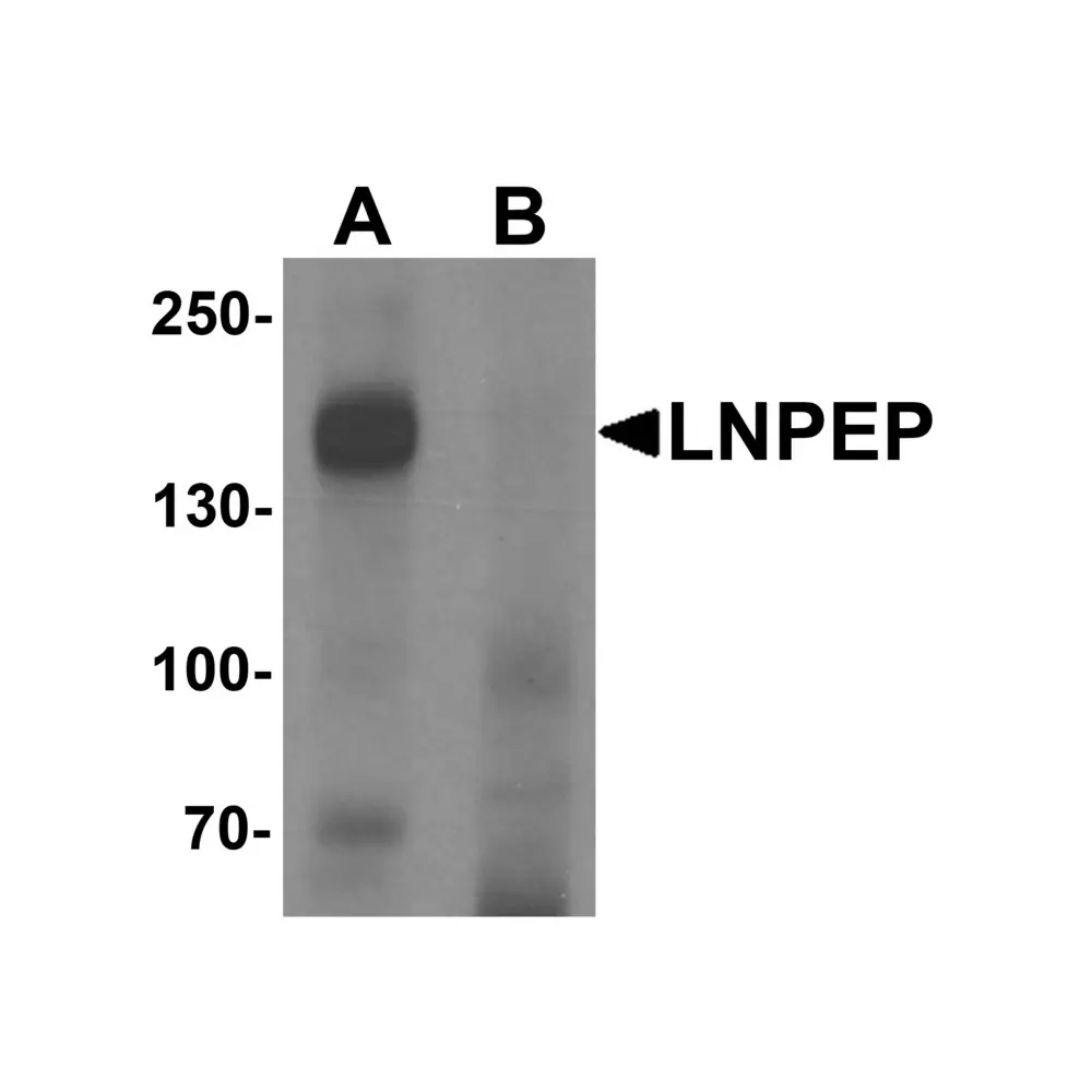 ProSci 7055_S LNPEP Antibody, ProSci, 0.02 mg/Unit Primary Image