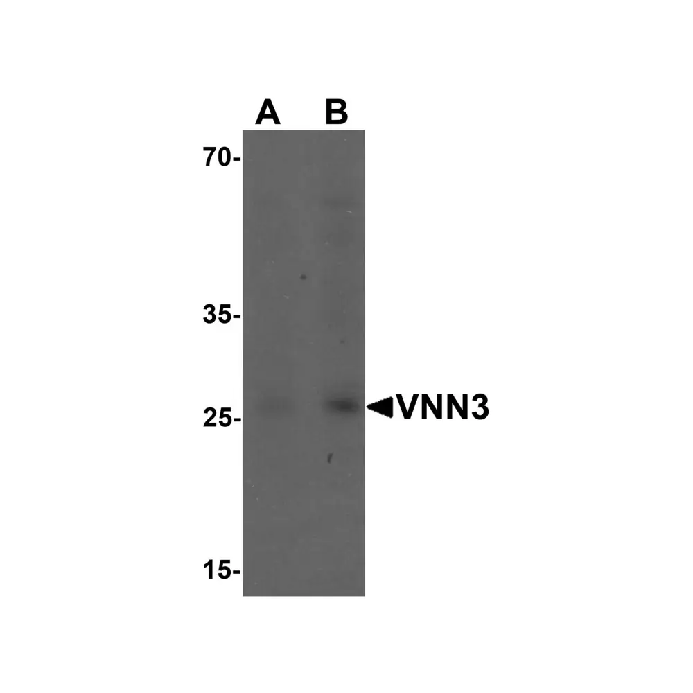 ProSci 7057_S VNN3 Antibody, ProSci, 0.02 mg/Unit Primary Image
