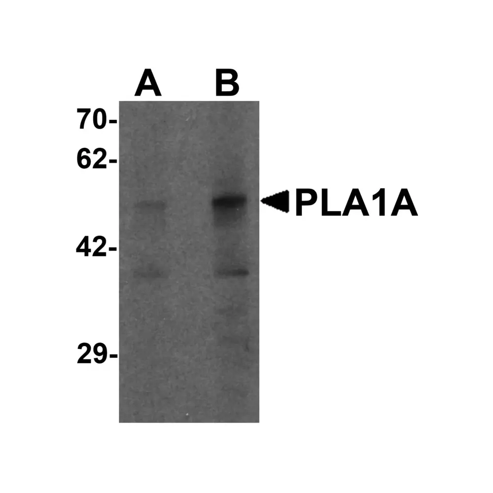 ProSci 7059_S PLA1A Antibody, ProSci, 0.02 mg/Unit Primary Image