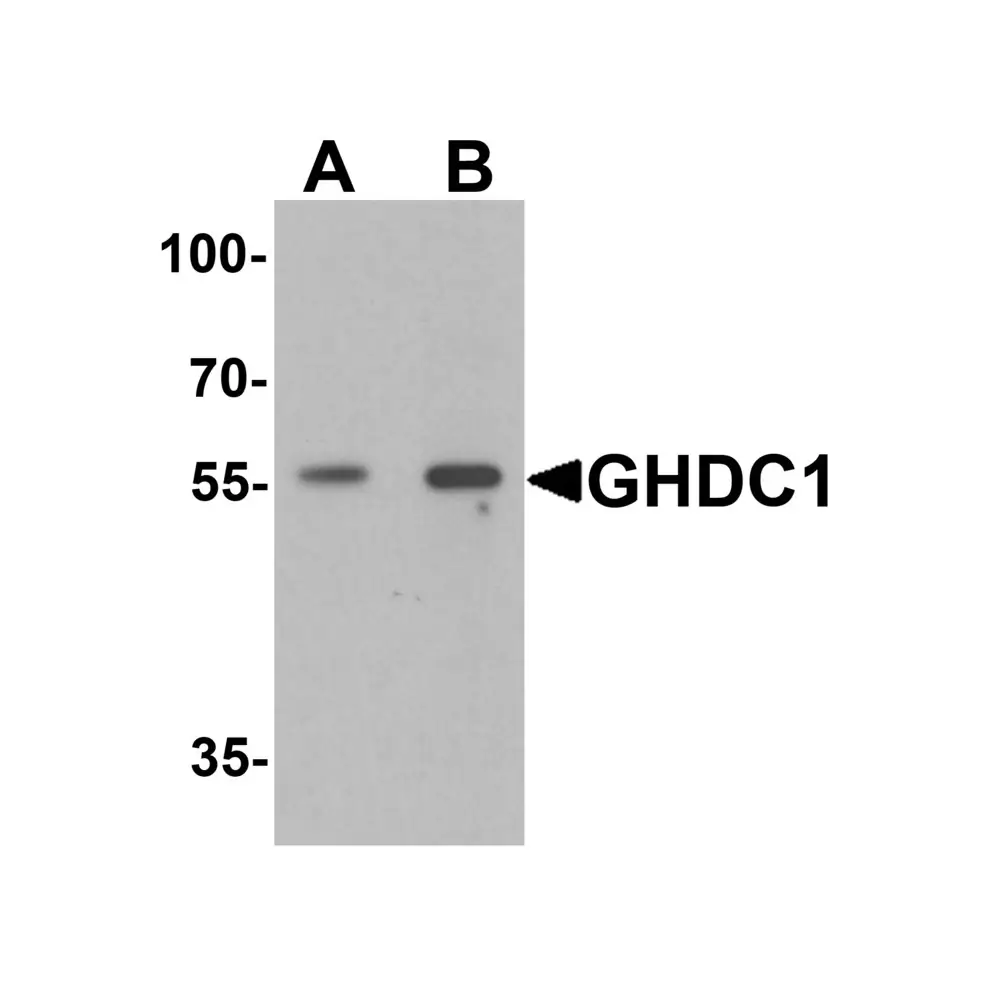 ProSci 7061_S GHDC Antibody, ProSci, 0.02 mg/Unit Primary Image