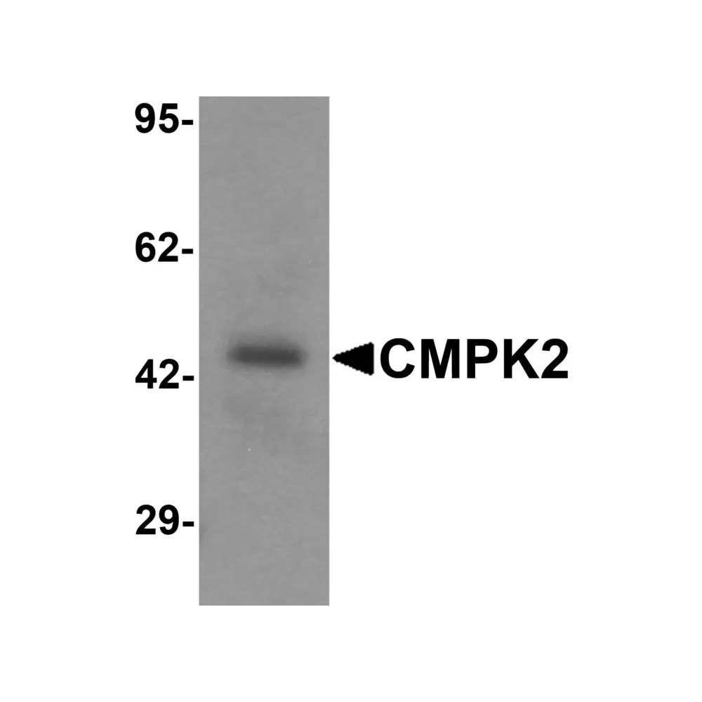 ProSci 7063 CMPK2 Antibody, ProSci, 0.1 mg/Unit Primary Image