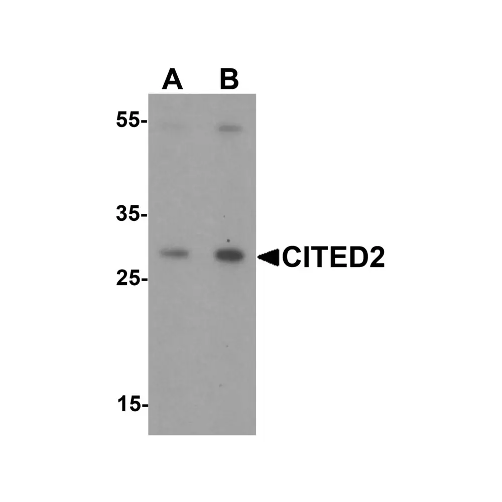ProSci 7067 CITED2 Antibody, ProSci, 0.1 mg/Unit Primary Image