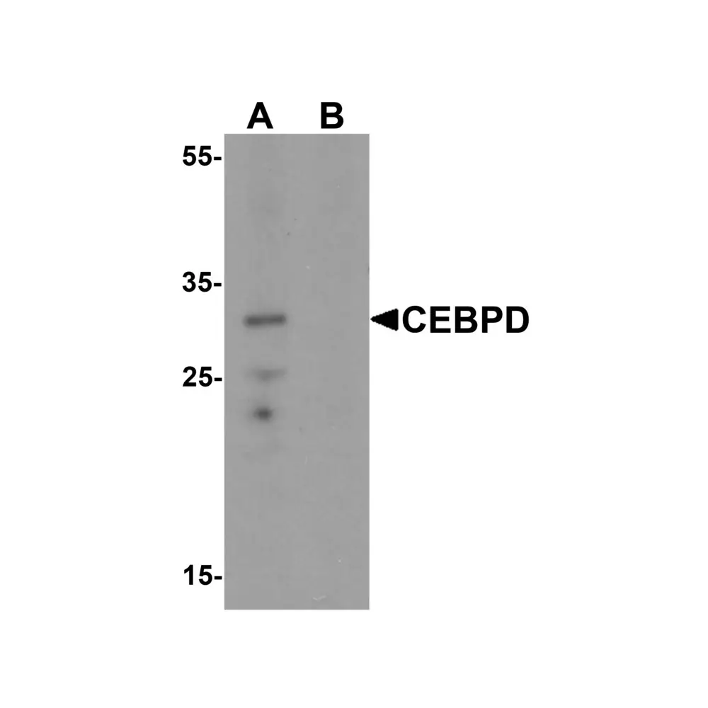 ProSci 7077_S CEBPD Antibody, ProSci, 0.02 mg/Unit Primary Image