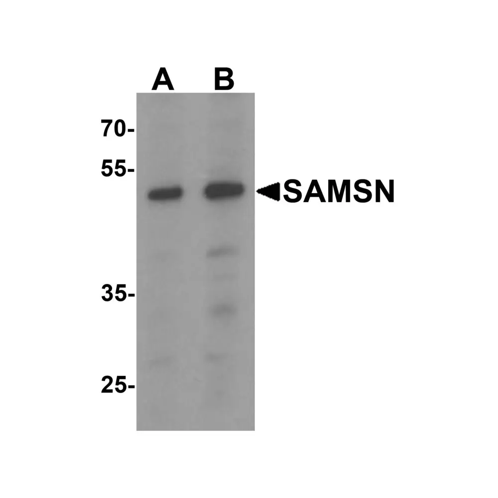 ProSci 7079 SAMSN Antibody, ProSci, 0.1 mg/Unit Primary Image