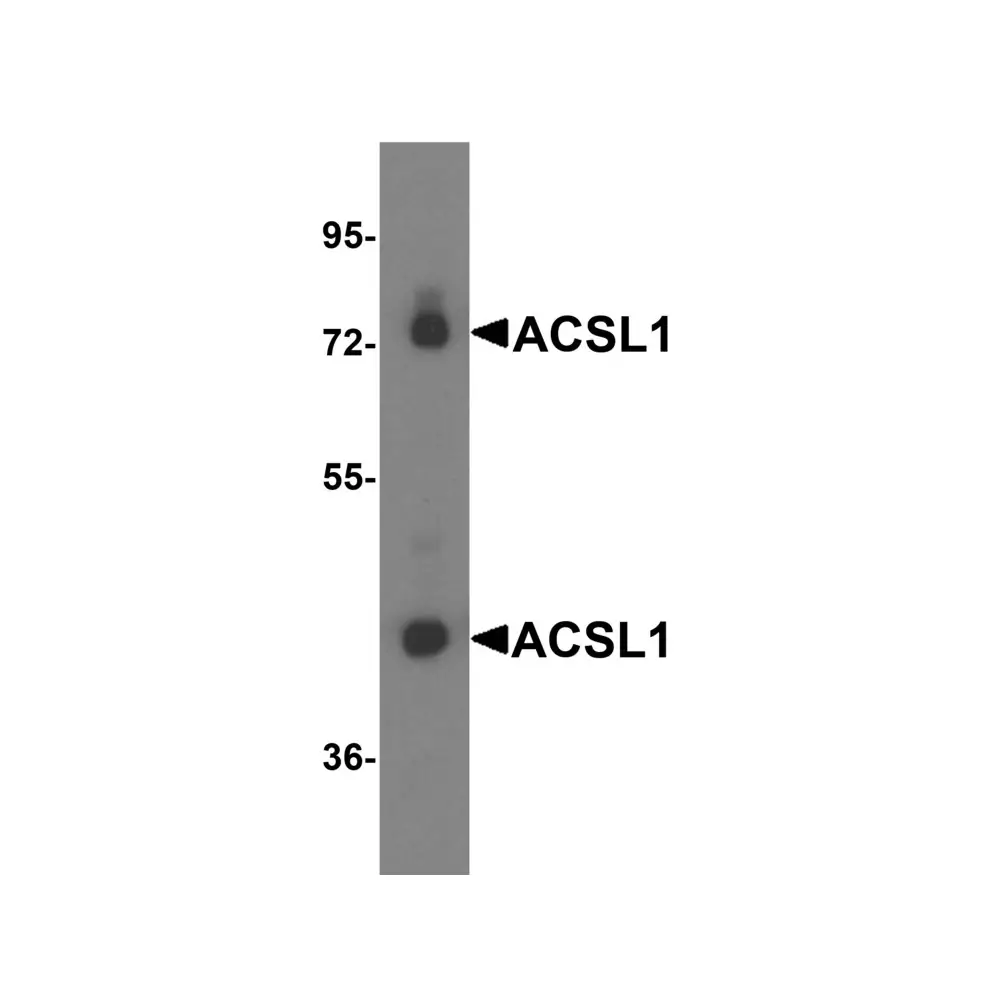 ProSci 7081 ACSL1 Antibody, ProSci, 0.1 mg/Unit Primary Image