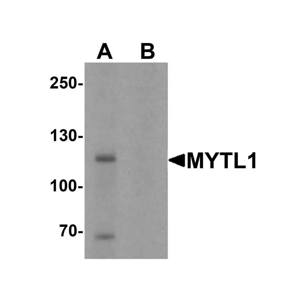 ProSci 7083 MYT1L Antibody, ProSci, 0.1 mg/Unit Primary Image