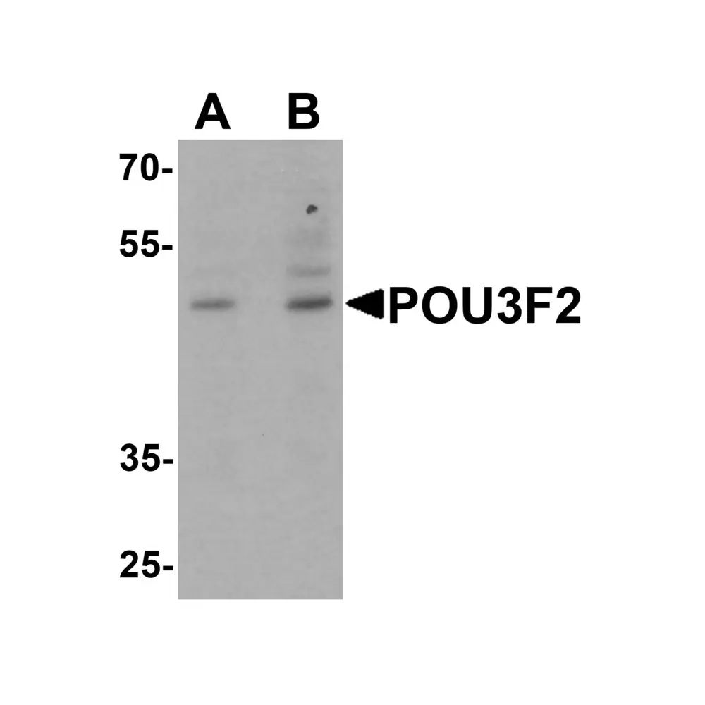 ProSci 7085 POU3F2 Antibody, ProSci, 0.1 mg/Unit Primary Image
