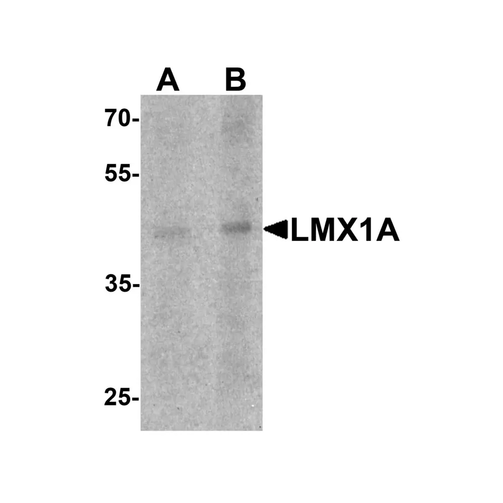 ProSci 7087_S LMX1A Antibody, ProSci, 0.02 mg/Unit Primary Image