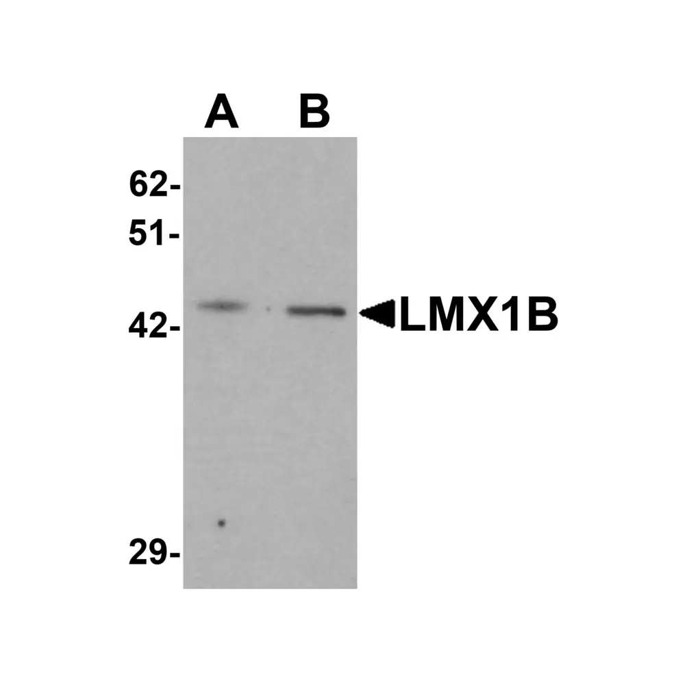 ProSci 7089 LMX1B Antibody, ProSci, 0.1 mg/Unit Primary Image