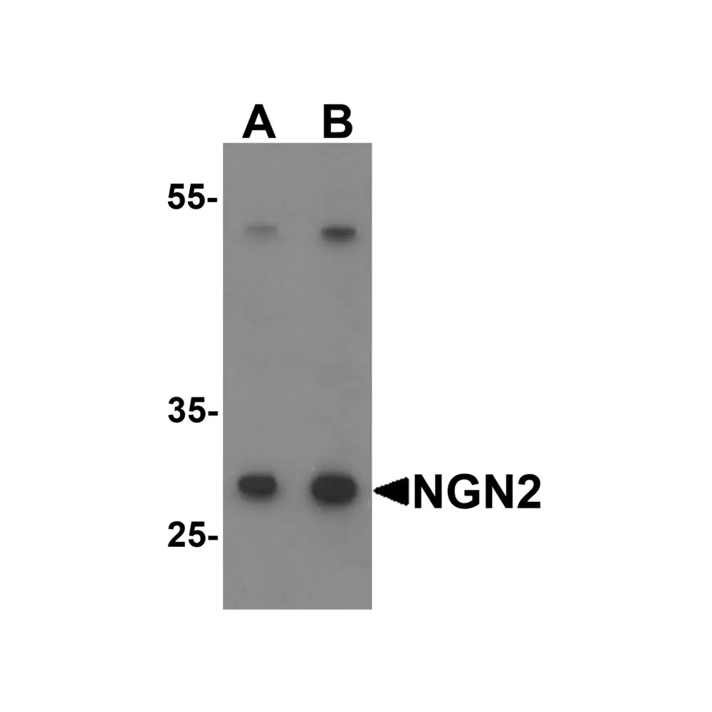 ProSci 7091 NGN2 Antibody, ProSci, 0.1 mg/Unit Primary Image