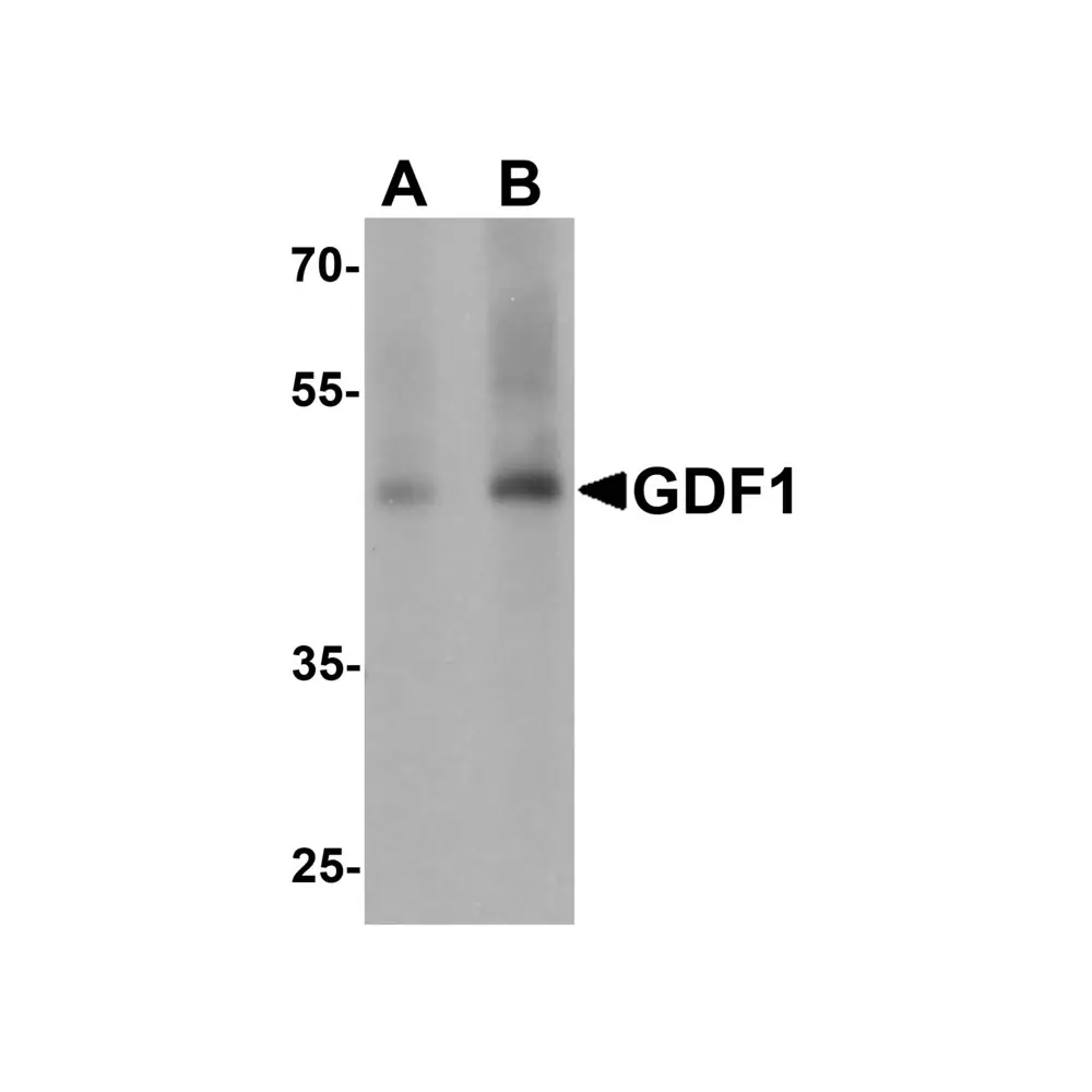ProSci 7093 GDF1 Antibody, ProSci, 0.1 mg/Unit Primary Image