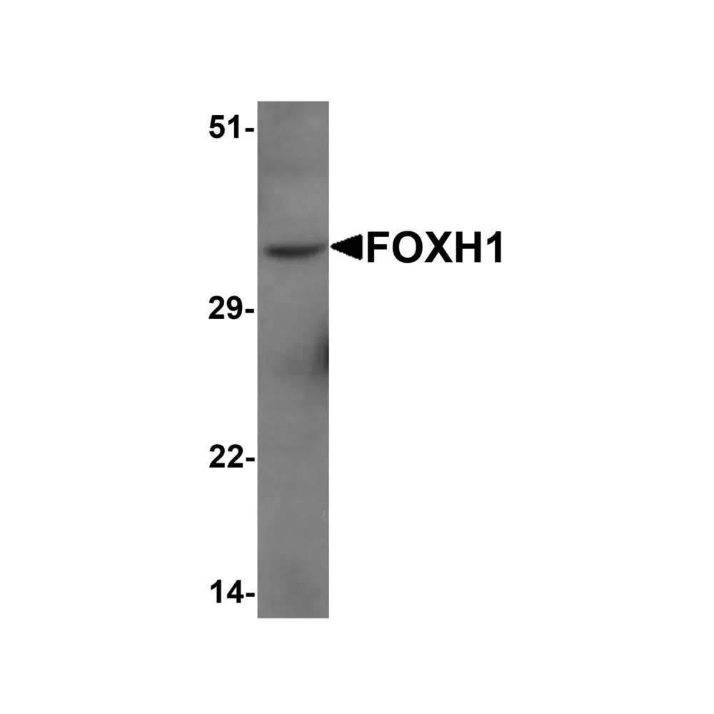 ProSci 7095_S FOXH1 Antibody, ProSci, 0.02 mg/Unit Primary Image