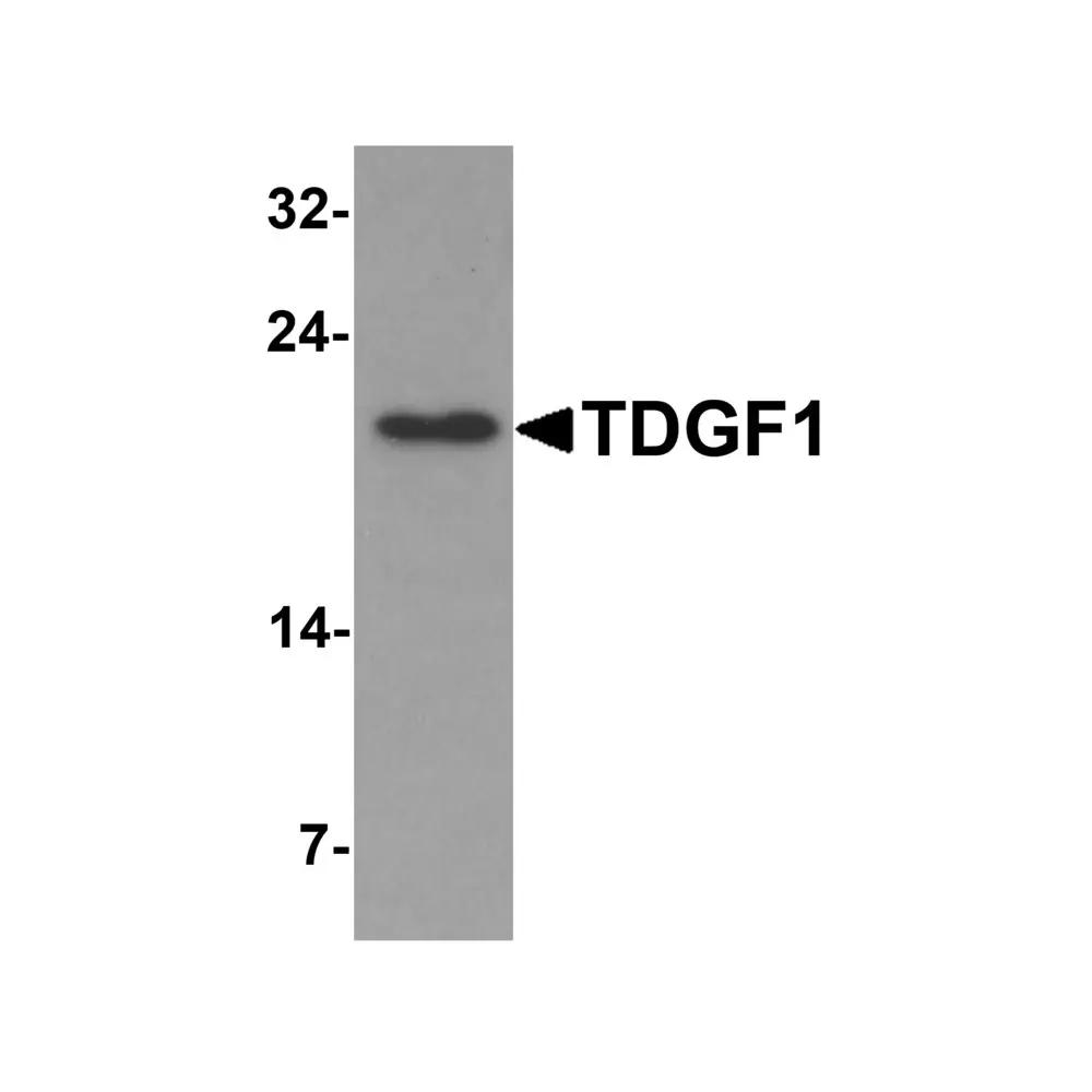 ProSci 7099 TDGF1 Antibody, ProSci, 0.1 mg/Unit Primary Image