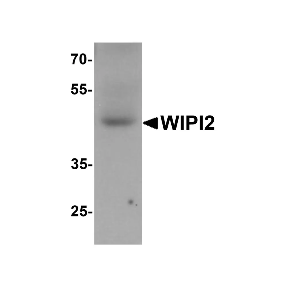 ProSci 7103 WIPI2 Antibody, ProSci, 0.1 mg/Unit Primary Image