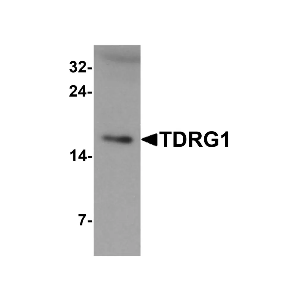 ProSci 7105 TDRG1 Antibody, ProSci, 0.1 mg/Unit Primary Image