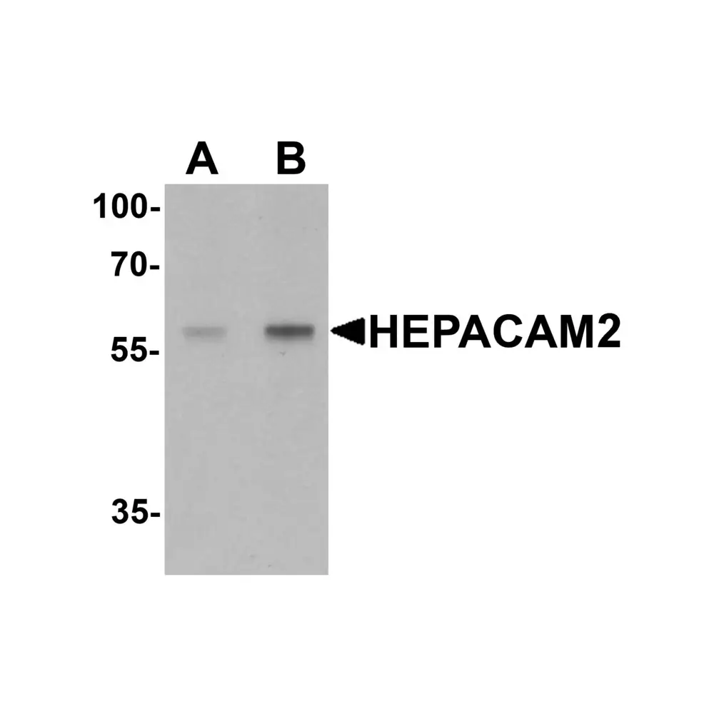 ProSci 7111_S HEPACAM2 Antibody, ProSci, 0.02 mg/Unit Primary Image
