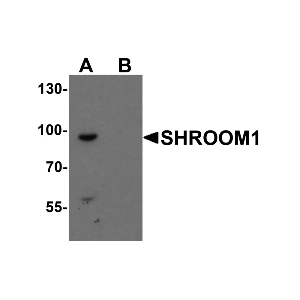 ProSci 7113 SHROOM1 Antibody, ProSci, 0.1 mg/Unit Primary Image