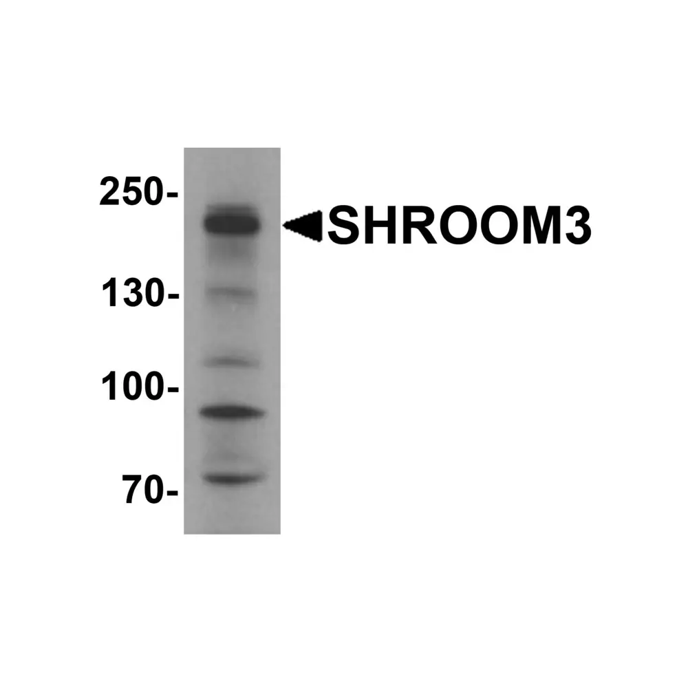 ProSci 7117_S SHROOM3 Antibody, ProSci, 0.02 mg/Unit Primary Image