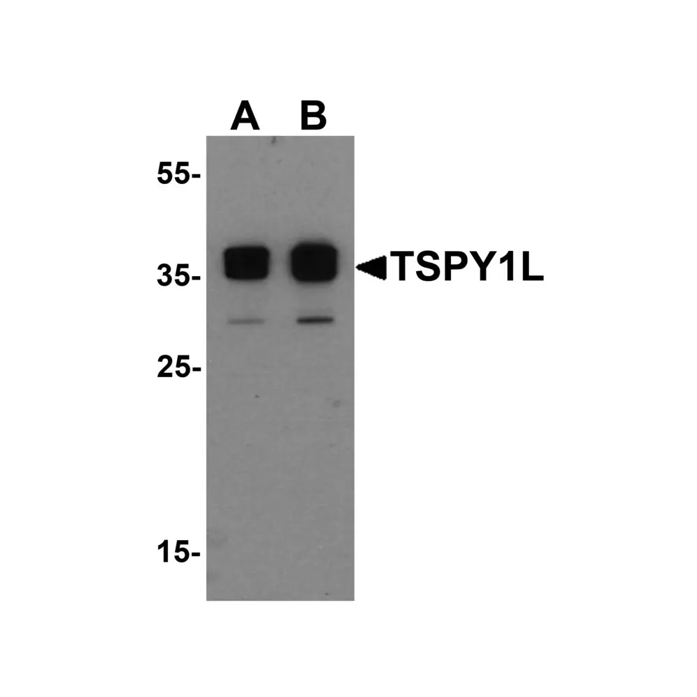 ProSci 7121 TSPY1L Antibody, ProSci, 0.1 mg/Unit Primary Image