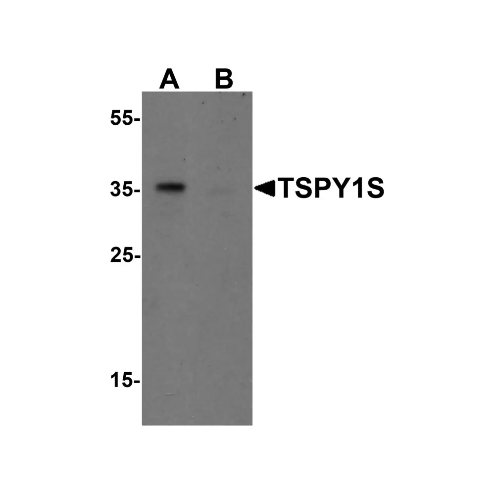 ProSci 7123_S TSPY1S Antibody, ProSci, 0.02 mg/Unit Primary Image