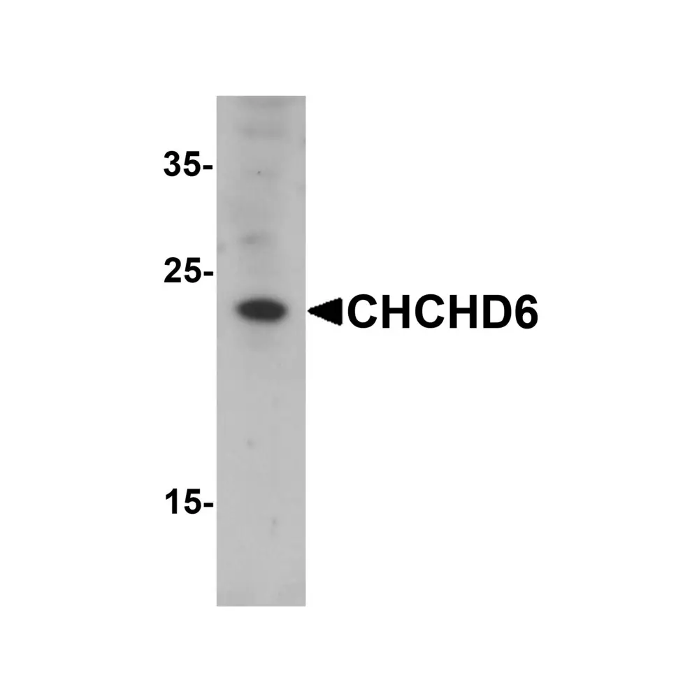 ProSci 7133 CHCHD6 Antibody, ProSci, 0.1 mg/Unit Primary Image