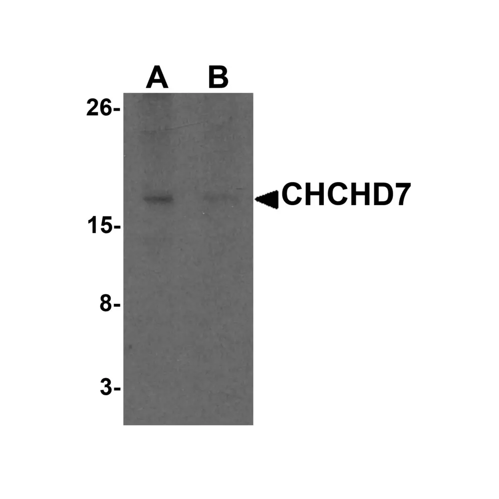 ProSci 7143 CHCHD7 Antibody, ProSci, 0.1 mg/Unit Primary Image