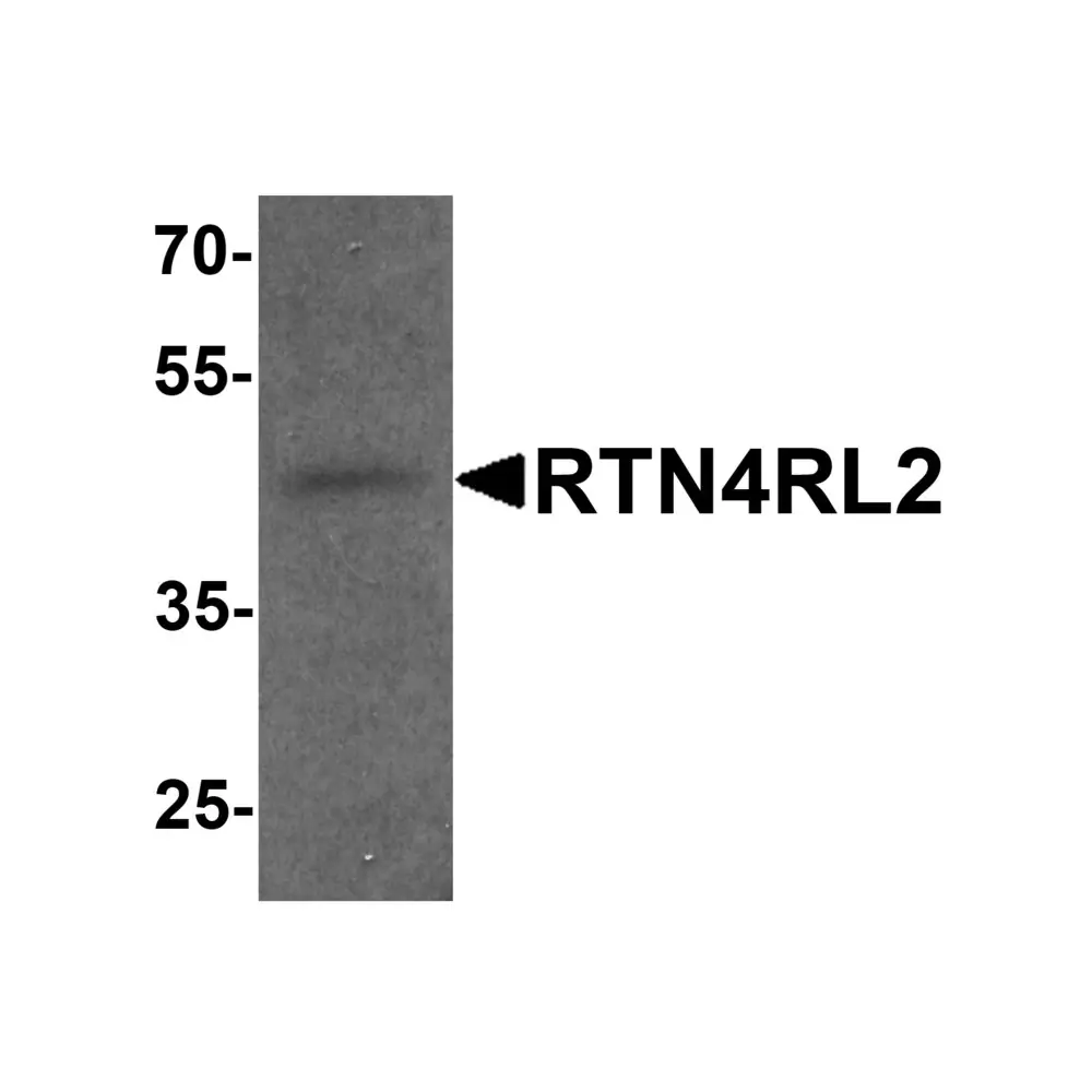 ProSci 7145_S RTN4RL2 Antibody, ProSci, 0.02 mg/Unit Primary Image