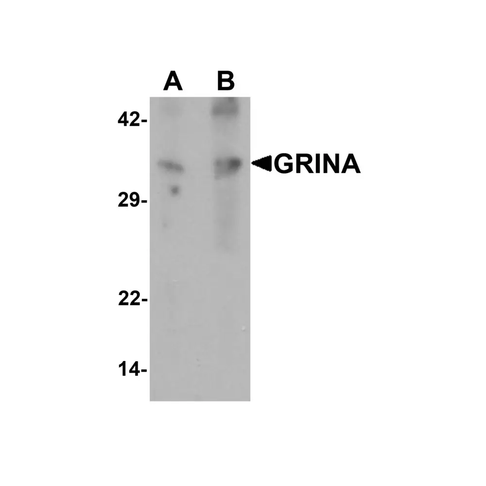 ProSci 7147 GRINA Antibody, ProSci, 0.1 mg/Unit Primary Image