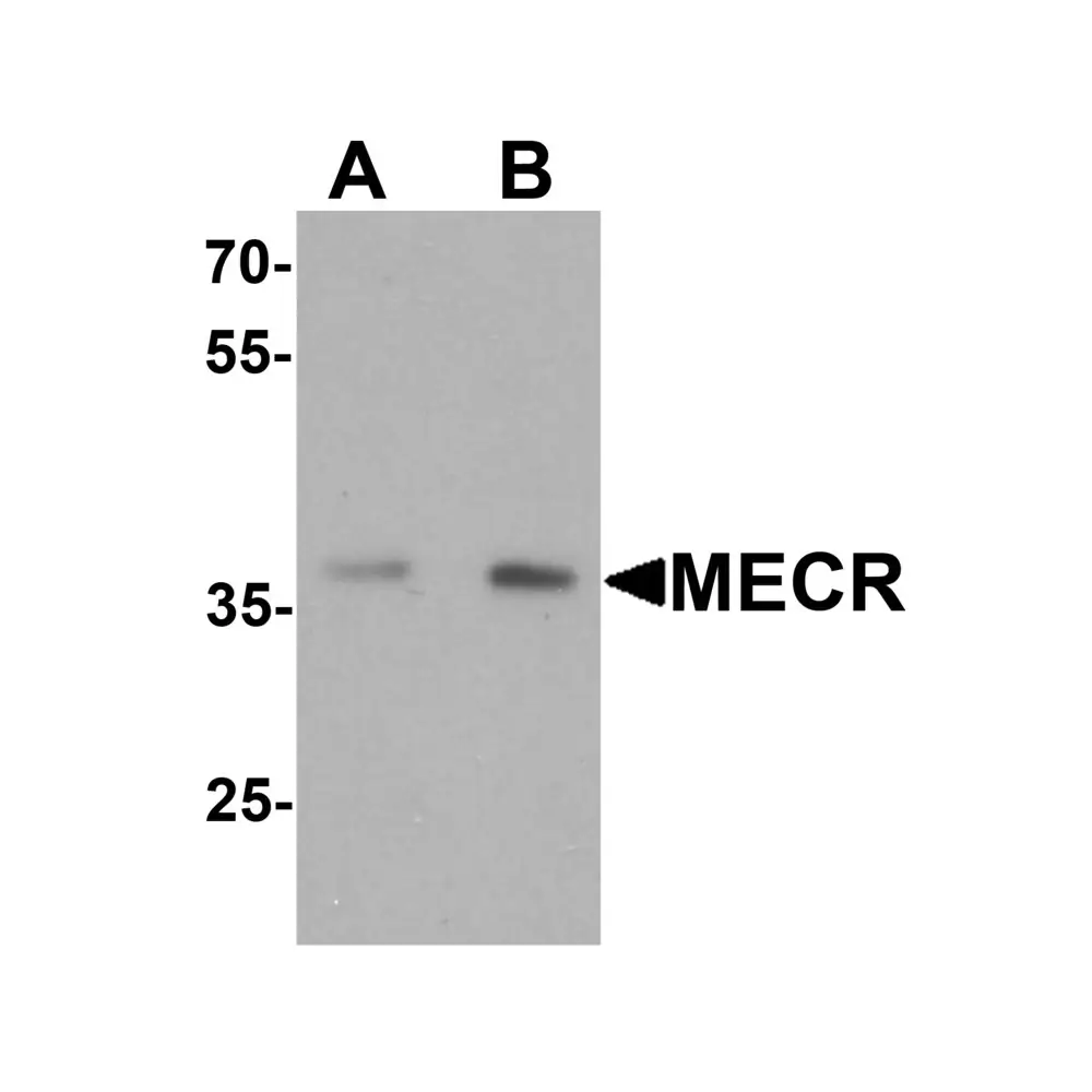 ProSci 7151 MECR Antibody, ProSci, 0.1 mg/Unit Primary Image