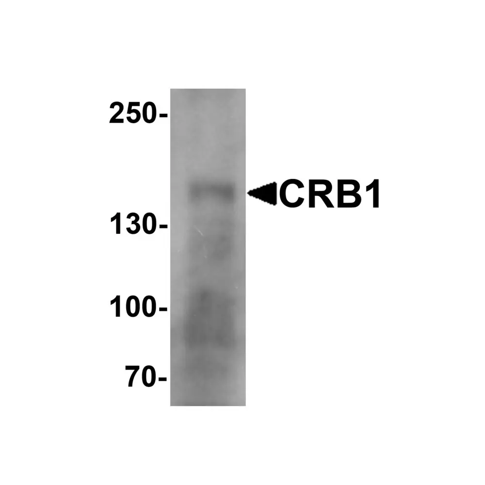 ProSci 7153 CRB1 Antibody, ProSci, 0.1 mg/Unit Primary Image