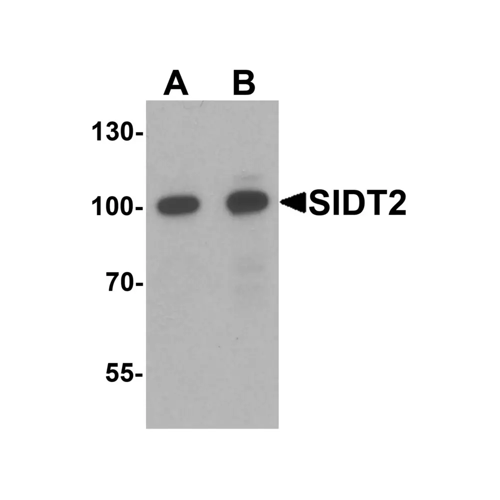 ProSci 7159 SIDT2 Antibody, ProSci, 0.1 mg/Unit Primary Image