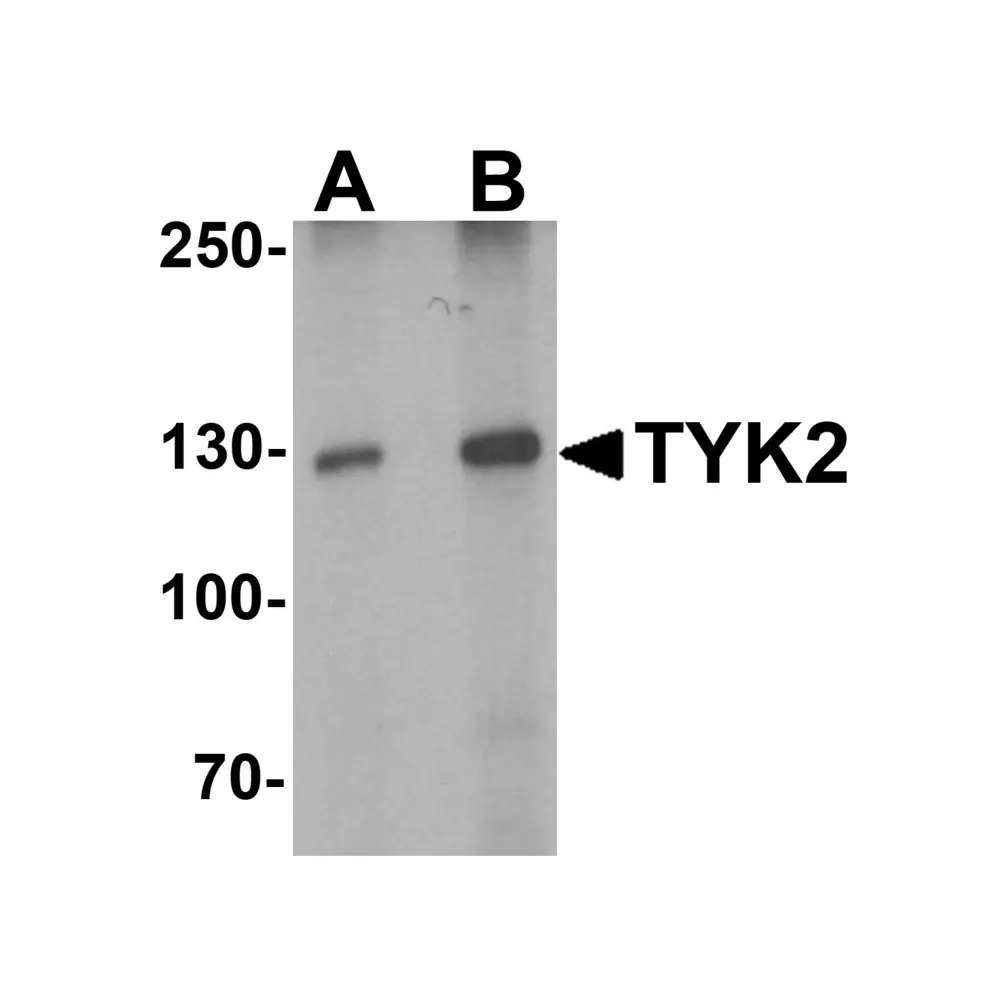 ProSci 7177_S TYK2 Antibody, ProSci, 0.02 mg/Unit Primary Image