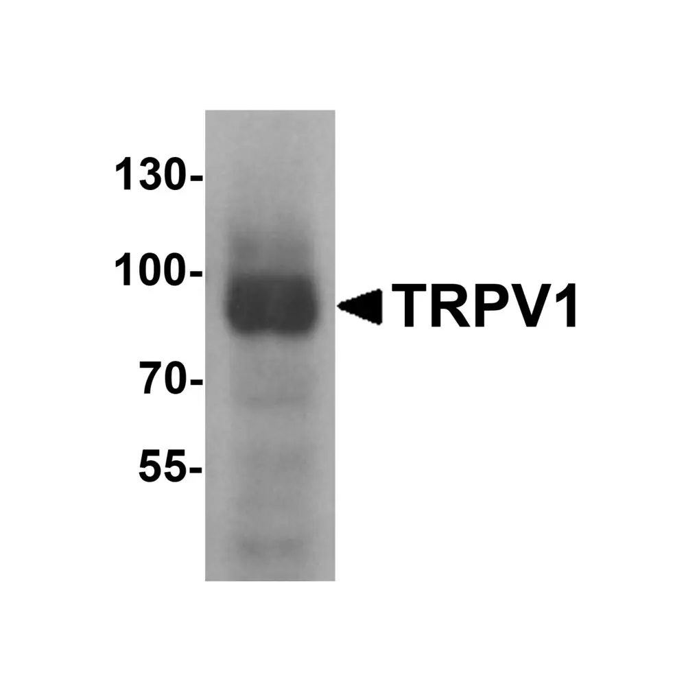 ProSci 7179 TRPV1 Antibody, ProSci, 0.1 mg/Unit Primary Image