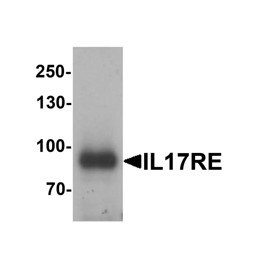 ProSci 7181 IL-17RE Antibody, ProSci, 0.1 mg/Unit Primary Image