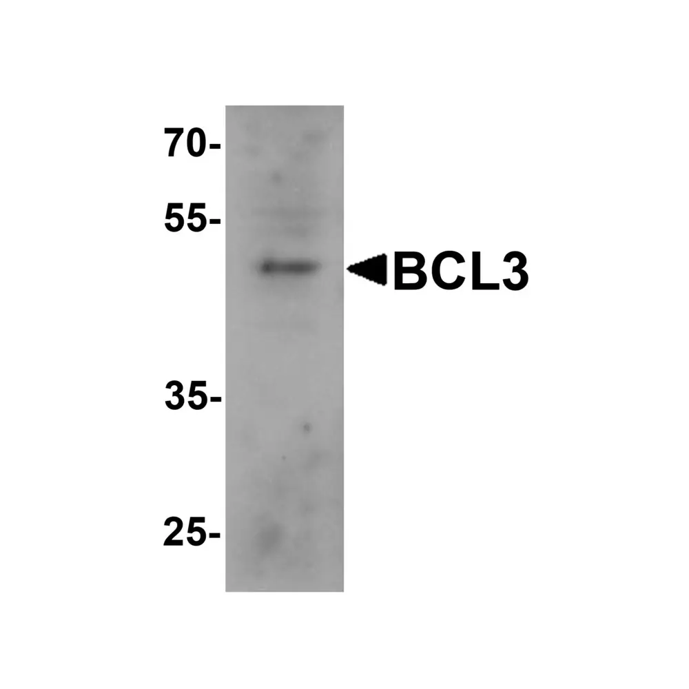 ProSci 7183 BCL3 Antibody, ProSci, 0.1 mg/Unit Primary Image