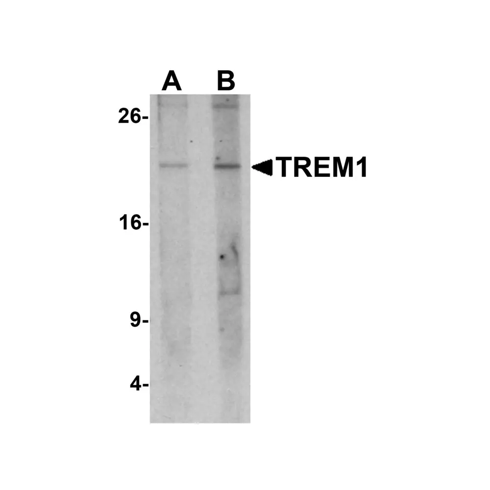 ProSci 7185 TREM1 Antibody, ProSci, 0.1 mg/Unit Primary Image