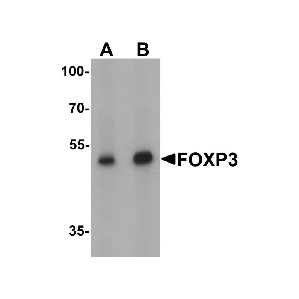 ProSci 7187 FOXP3 Antibody, ProSci, 0.1 mg/Unit Primary Image