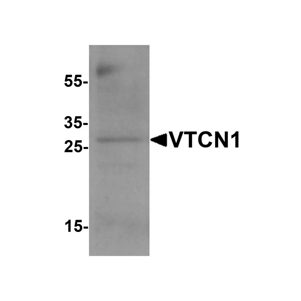 ProSci 7189 VTCN1 Antibody, ProSci, 0.1 mg/Unit Primary Image