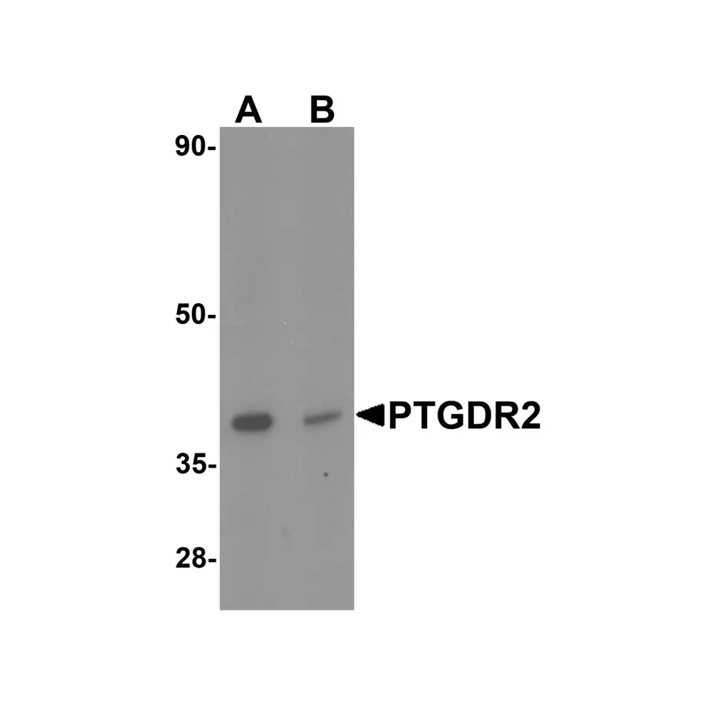 ProSci 7191 PTGDR2 Antibody, ProSci, 0.1 mg/Unit Primary Image