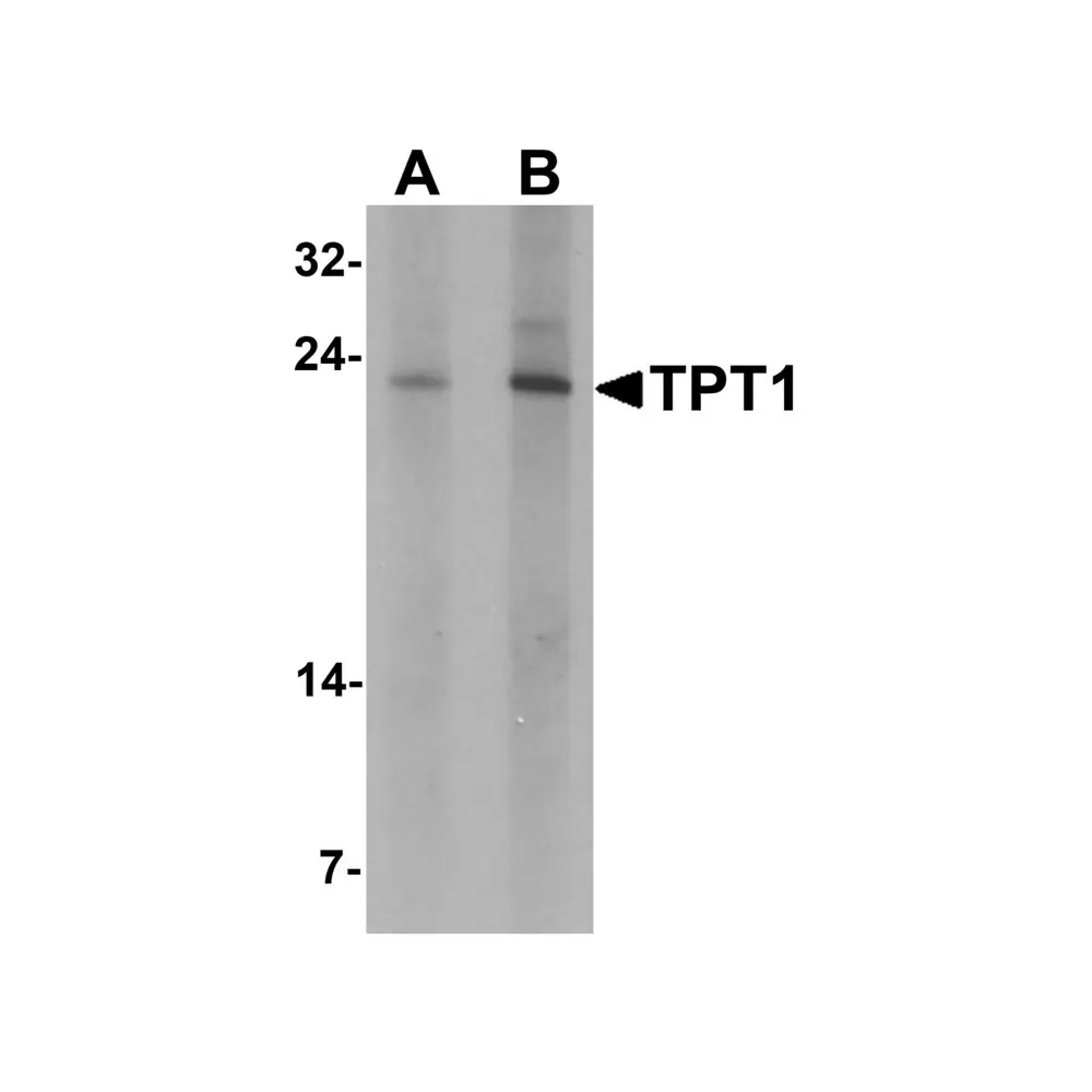 ProSci 7193 TPT1 Antibody, ProSci, 0.1 mg/Unit Primary Image