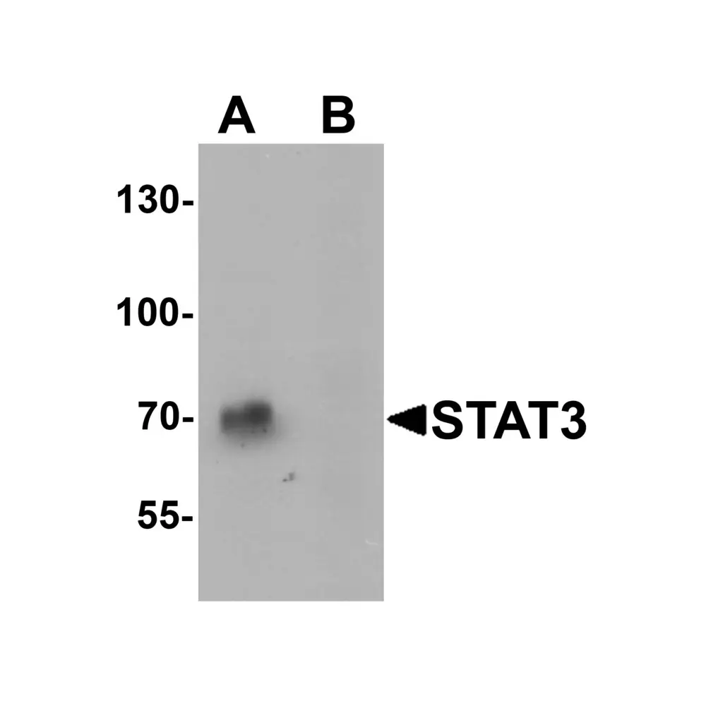 ProSci 7197 STAT3 Antibody, ProSci, 0.1 mg/Unit Primary Image