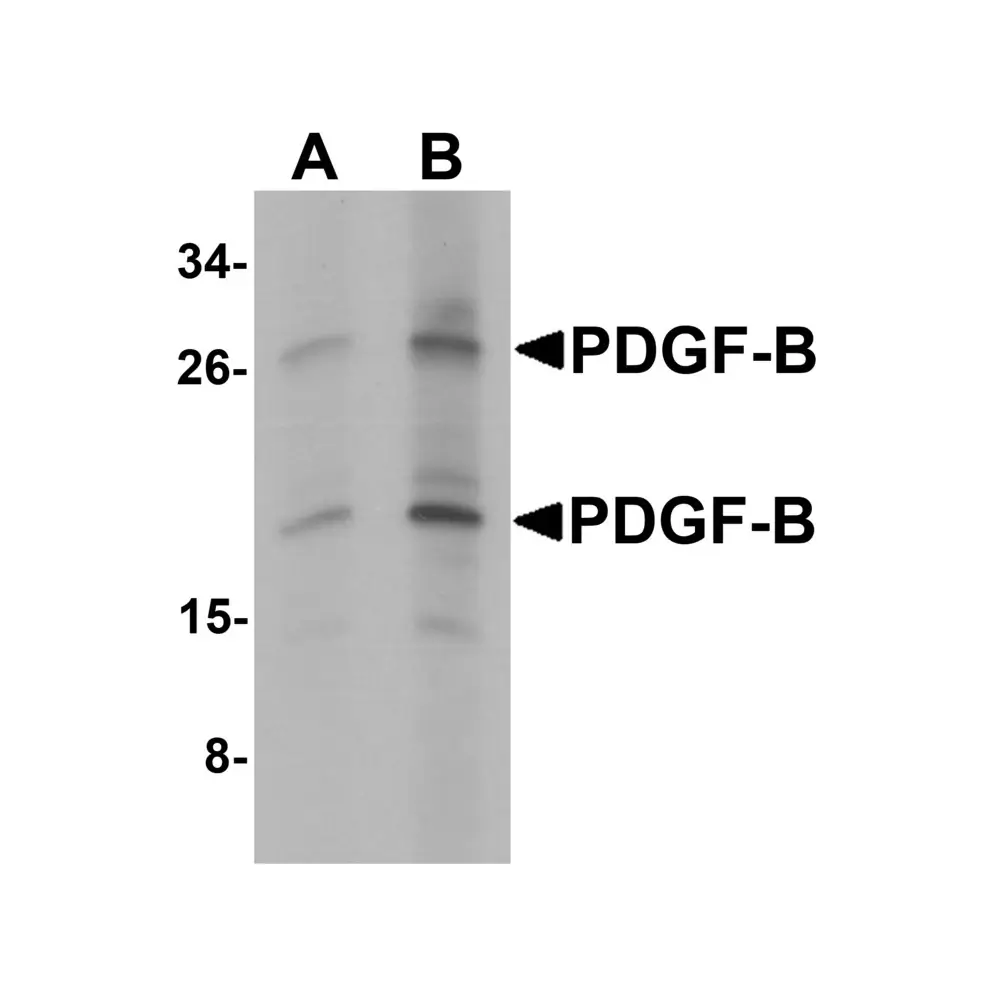 ProSci 7199_S PDGF-B Antibody, ProSci, 0.02 mg/Unit Primary Image
