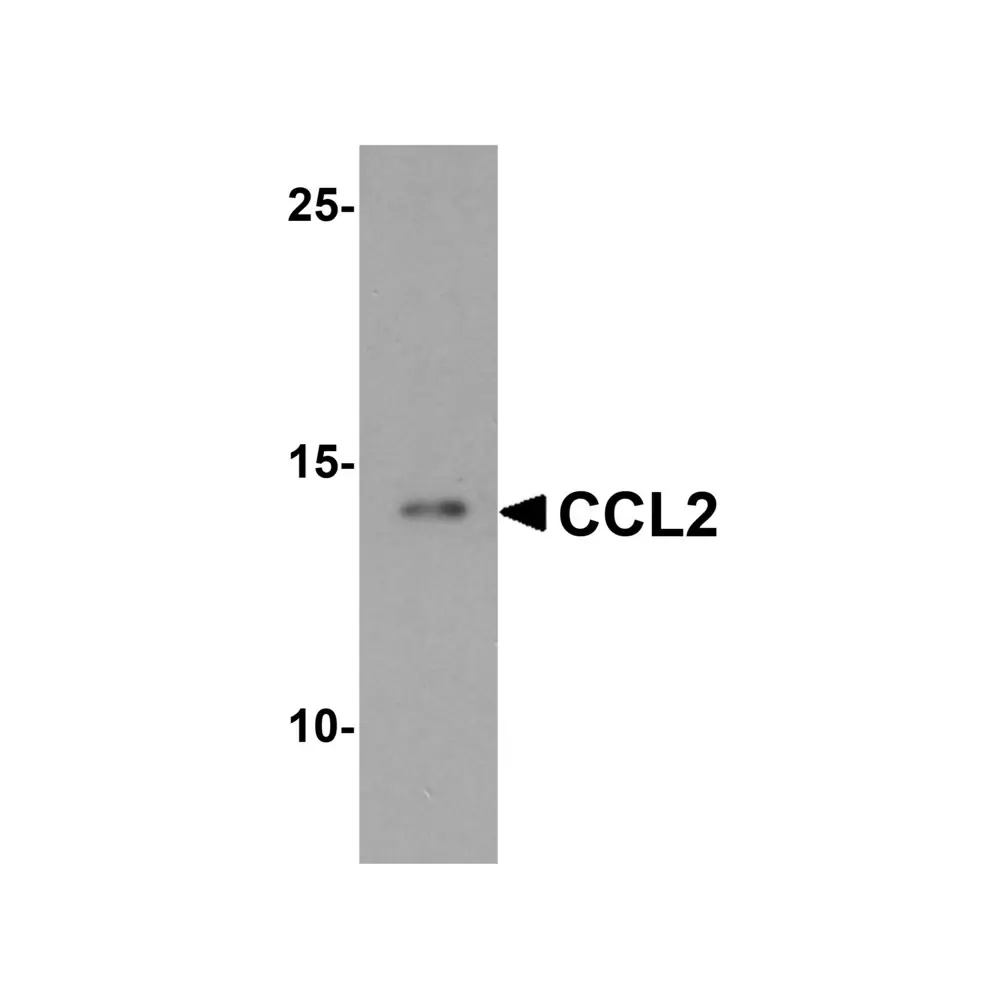 ProSci 7201 CCL2 Antibody, ProSci, 0.1 mg/Unit Primary Image