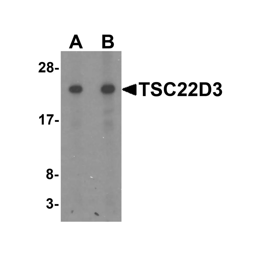 ProSci 7221_S TSC22D3 Antibody, ProSci, 0.02 mg/Unit Primary Image