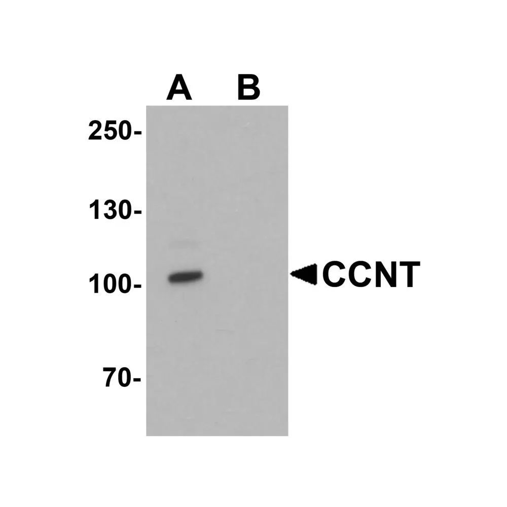 ProSci 7223 CCNT1 Antibody, ProSci, 0.1 mg/Unit Primary Image