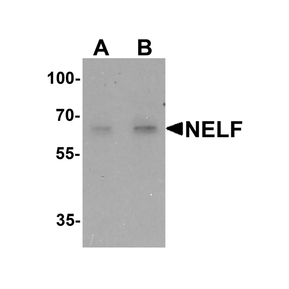 ProSci 7225_S NELF Antibody, ProSci, 0.02 mg/Unit Primary Image