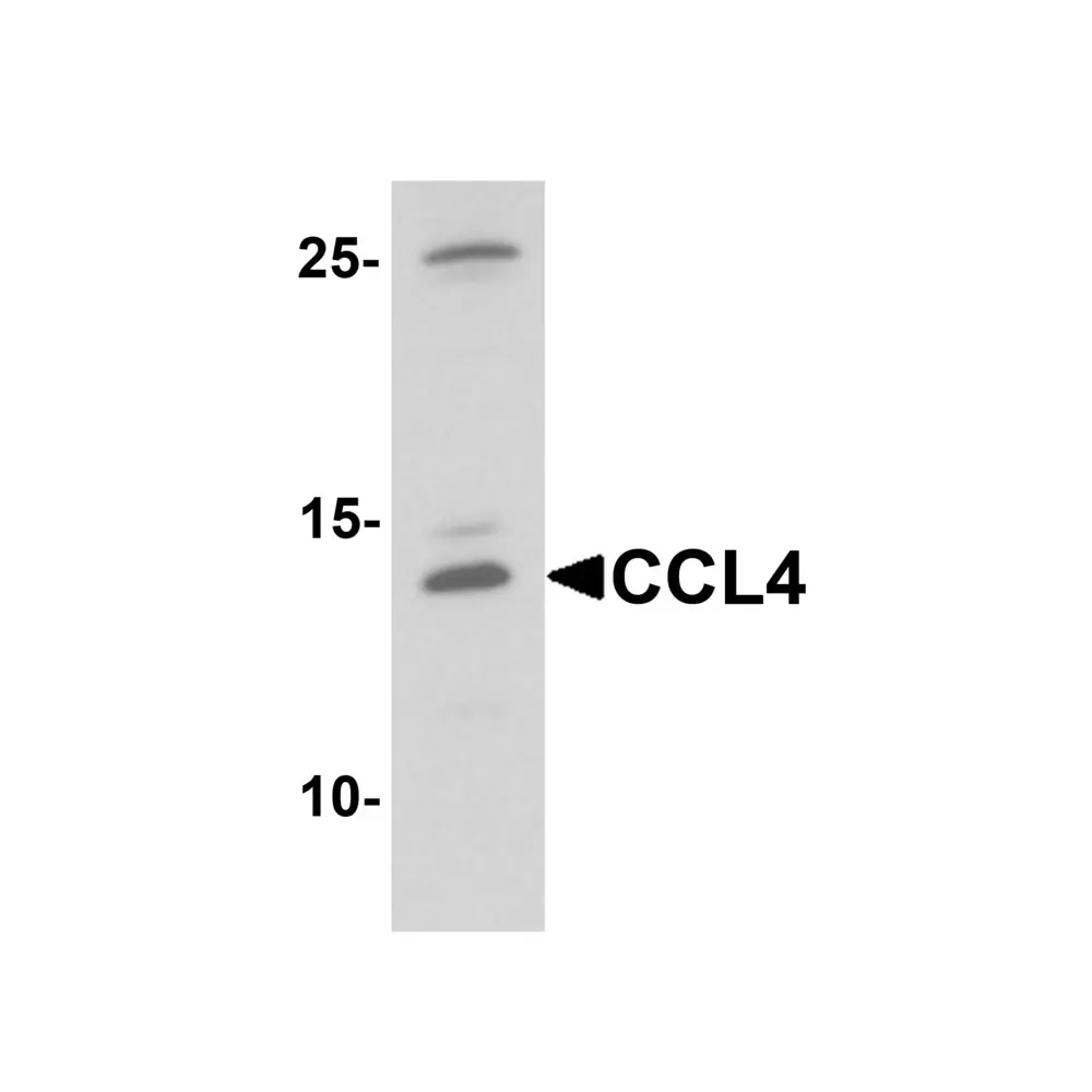 ProSci 7227_S CCL4 Antibody, ProSci, 0.02 mg/Unit Primary Image